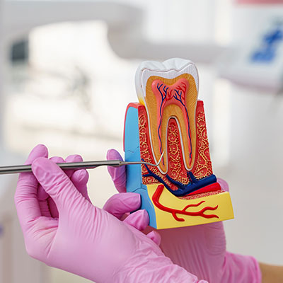 Root Canal Treatment in Vijayawada